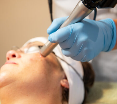 PicoStar Fractionele huidverbetering PicoStar Fractionele huidverbetering