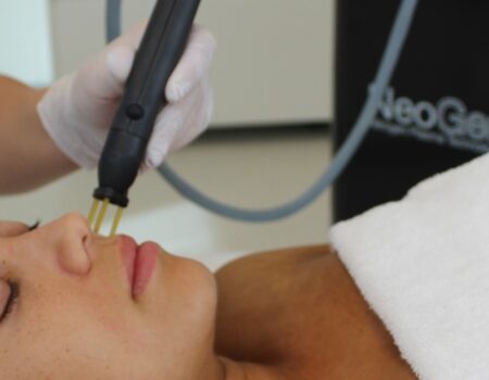 Neogen stikstofplasma Huidverbetering Skin Medic