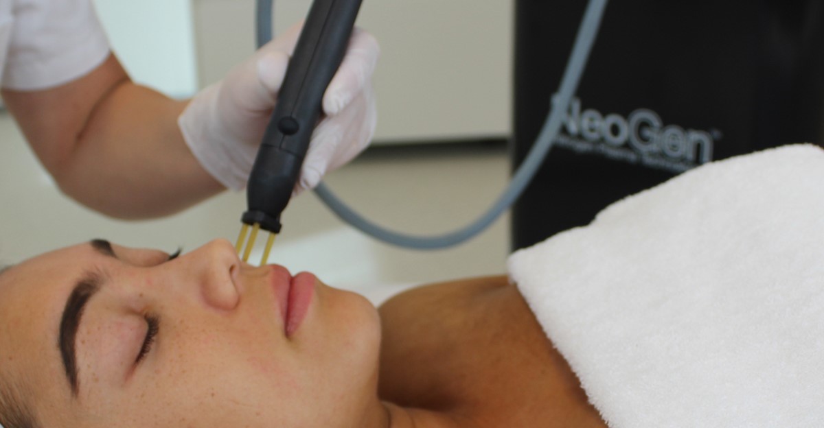 Neogen stikstofplasma Huidverbetering Skin Medic