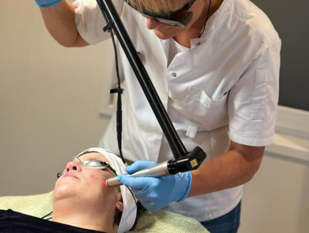 Picolaser huidverbetering Skin Medic