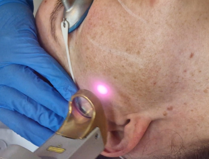 herfstspecial Skin Medic