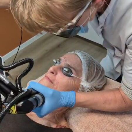 Dermablate erbium yag Skin Medic Dermablate erbium yag Skin Medic