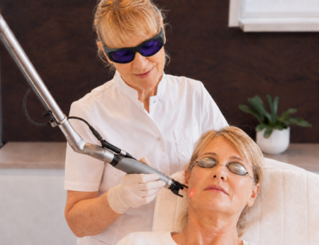 CO2 Laser behandeling Skin Medic